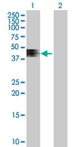 ZNRF4 Antibody in Western Blot (WB)
