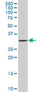 MOBKL2C Antibody in Western Blot (WB)