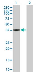 WDSUB1 Antibody in Western Blot (WB)