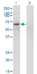MAGEB6 Antibody in Western Blot (WB)
