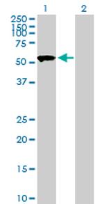 SASS6 Antibody in Western Blot (WB)