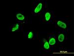 RNF168 Antibody in Immunocytochemistry (ICC/IF)