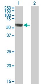 ACSF3 Antibody in Western Blot (WB)