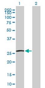 GSTA5 Antibody in Western Blot (WB)