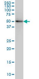 SLC29A4 Antibody in Western Blot (WB)
