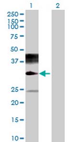 NAALADL2 Antibody in Western Blot (WB)
