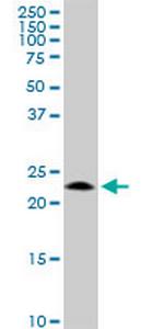 GCET2 Antibody in Western Blot (WB)