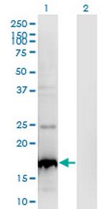 BLOC1S2 Antibody in Western Blot (WB)