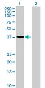 MGC33407 Antibody in Western Blot (WB)