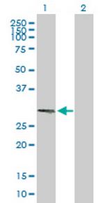 RNF212 Antibody in Western Blot (WB)