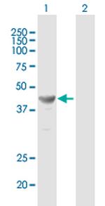 TFAP2E Antibody in Western Blot (WB)