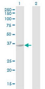 HSD17B13 Antibody in Western Blot (WB)