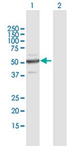 ZNF772 Antibody in Western Blot (WB)