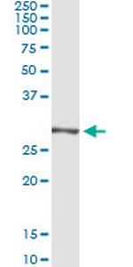 TRIM72 Antibody in Immunoprecipitation (IP)