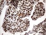 H2AFY2 Antibody in Immunohistochemistry (Paraffin) (IHC (P))