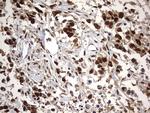 H2AFY2 Antibody in Immunohistochemistry (Paraffin) (IHC (P))