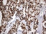 H2AFY2 Antibody in Immunohistochemistry (Paraffin) (IHC (P))