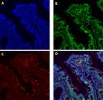 Goat IgG (H+L) Cross-Adsorbed Secondary Antibody in Immunocytochemistry (ICC/IF)