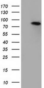 H6PD Antibody in Western Blot (WB)