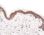 LAMB3 Antibody in Immunohistochemistry (Paraffin) (IHC (P))