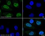 Histone H3 (acetyl K27) Antibody in Immunocytochemistry (ICC/IF)