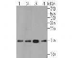 Histone H3 (acetyl K27) Antibody in Western Blot (WB)