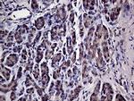 HABP2 Antibody in Immunohistochemistry (Paraffin) (IHC (P))