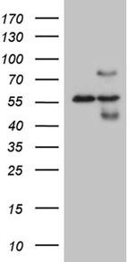 HABP2 Antibody in Western Blot (WB)