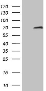 HABP2 Antibody in Western Blot (WB)