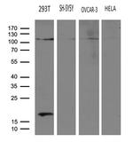 HACE1 Antibody in Western Blot (WB)