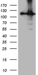 HACE1 Antibody in Western Blot (WB)