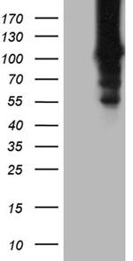 HACE1 Antibody in Western Blot (WB)