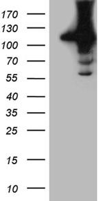 HACE1 Antibody in Western Blot (WB)