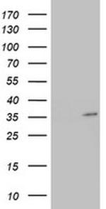 HADH Antibody in Western Blot (WB)