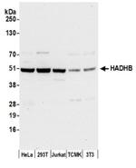 HADHB Antibody in Western Blot (WB)