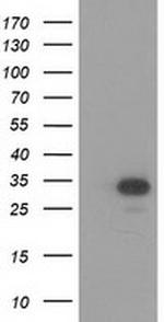 HAGHL Antibody in Western Blot (WB)