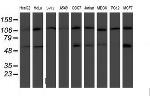 HARS2 Antibody in Western Blot (WB)