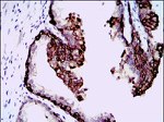 HAS3 Antibody in Immunohistochemistry (Paraffin) (IHC (P))