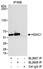 HDAC1 Antibody in Immunoprecipitation (IP)