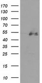 HDAC1 Antibody in Western Blot (WB)