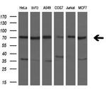 HDAC10 Antibody in Western Blot (WB)