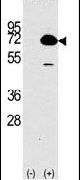 HDAC10 Antibody in Western Blot (WB)