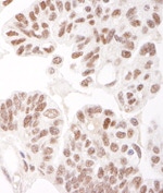 HDAC2 Antibody in Immunohistochemistry (IHC)