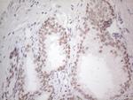 HDAC2 Antibody in Immunohistochemistry (Paraffin) (IHC (P))