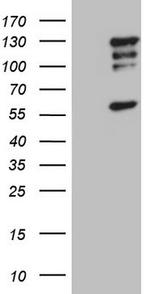 HDAC4 Antibody in Western Blot (WB)