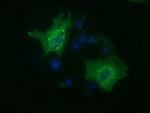 HDAC6 Antibody in Immunocytochemistry (ICC/IF)