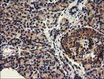 HDAC6 Antibody in Immunohistochemistry (Paraffin) (IHC (P))