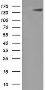 HDAC6 Antibody in Western Blot (WB)