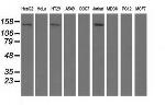 HDAC6 Antibody in Western Blot (WB)