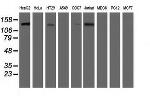 HDAC6 Antibody in Western Blot (WB)